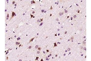 Paraformaldehyde-fixed, paraffin embedded rat brain, Antigen retrieval by boiling in sodium citrate buffer (pH6) for 15min, Block endogenous peroxidase by 3% hydrogen peroxide for 30 minutes, Blocking buffer (normal goat serum) at 37°C for 20min, Antibody incubation with LIMK1 Polyclonal Antibody (bs-2775R) at 1:400 overnight at 4°C, followed by a conjugated secondary and DAB staining. (LIM Domain Kinase 1 antibody  (AA 451-550))