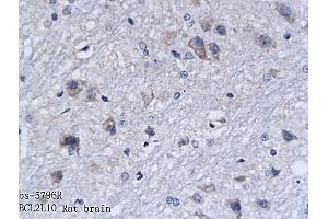 Formalin-fixed and paraffin embedded rat brain labeled with Anti-BCL2L10 Polyclonal Antibody, Unconjugated (ABIN714881) followed by conjugation to the secondary antibody and DAB staining (BCL2L10 antibody  (AA 101-194))