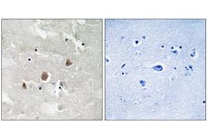 Immunohistochemistry analysis of paraffin-embedded human brain tissue using MAP3K1 (Phospho-Thr1402) antibody. (MAP3K1 antibody  (pThr1402))