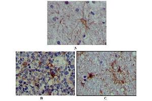 Immunohistochemical analysis of paraffin-embedded human brain tissue (A), lymphoid follicles tissue (B) and interbrain tissue (C), showing cytoplasmic localization using S100A antibody with DAB staining. (S100A1 antibody)