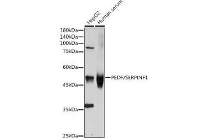 Western blot analysis of extracts of various cell lines, using SERPINF1 antibody (ABIN3022372, ABIN3022373, ABIN3022374, ABIN1513515 and ABIN6218766) at 1:1000 dilution. (PEDF antibody  (AA 1-200))