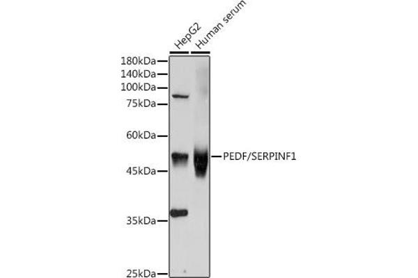 PEDF antibody  (AA 1-200)