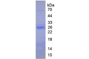 Image no. 1 for Trypsin protein (ABIN6237855) (Trypsin Protein)