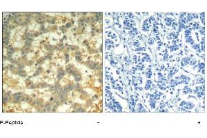Image no. 1 for anti-Spleen tyrosine Kinase (SYK) (pTyr323) antibody (ABIN319292) (SYK antibody  (pTyr323))