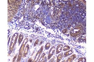 IHC analysis of RPS3 using anti-RPS3 antibody (ABIN6719371). (RPS3 antibody)