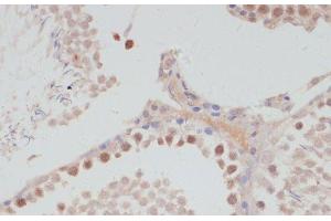 Immunohistochemistry of paraffin-embedded Rat testis using CCNG1 Polyclonal Antibody at dilution of 1:100 (40x lens). (Cyclin G1 antibody)