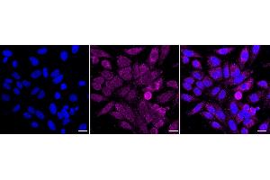 anti-Aconitase 2, Mitochondrial (ACO2) antibody
