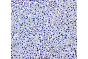 IHC analysis of GSTM1 using anti-GSTM1 antibody (ABIN5693233). (GSTM1 antibody)