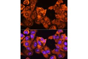 Immunofluorescence (IF) image for anti-Ribosomal Protein S3 (RPS3) (AA 1-243) antibody (ABIN3023343)