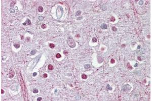 anti-2',3'-Cyclic Nucleotide 3' phosphodiesterase (CNP) (C-Term) antibody