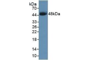 Detection of Recombinant SCCA1, Human using Polyclonal Antibody to Serpin B3 (SERPINB3) (SERPINB3 antibody  (AA 1-210))
