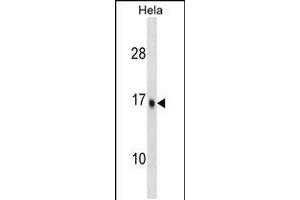 Western blot analysis in Hela cell line lysates (35ug/lane). (UBE2D3 antibody  (C-Term))