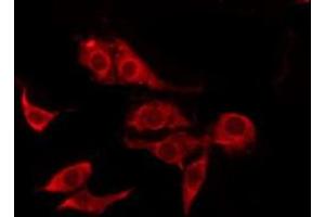 ABIN6277866 staining HepG2 by IF/ICC. (CD131 antibody  (C-Term))