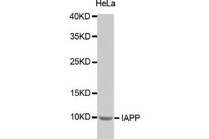 Western Blotting (WB) image for anti-Islet Amyloid Polypeptide (IAPP) antibody (ABIN1873117) (Amylin/DAP antibody)