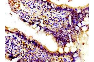 Immunohistochemistry of paraffin-embedded human small intestine tissue using ABIN7163188 at dilution of 1:100 (PIK3CA antibody  (Catalytic Subunit alpha))
