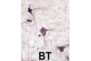 Formalin-fixed and paraffin-embedded human brain tissue reacted with PTPRR polyclonal antibody  , which was peroxidase-conjugated to the secondary antibody, followed by DAB staining. (PTPRR antibody  (N-Term))