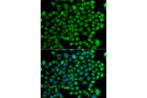 Immunofluorescence analysis of A549 cell using ZFYVE1 antibody.
