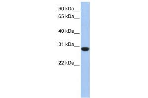 Western Blotting (WB) image for anti-Ankyrin Repeat and SOCS Box-Containing 12 (ASB12) antibody (ABIN2459538) (ASB12 antibody)