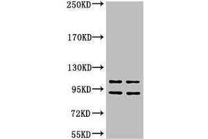 Western blot analysis of 1) Hela, 2) HepG2, diluted at 1:2000 (IDE antibody)