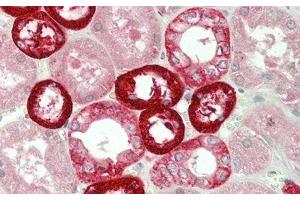Detection of NOX4 in Human Kidney Tissue using Polyclonal Antibody to NADPH Oxidase 4 (NOX4) (NADPH Oxidase 4 antibody  (AA 220-392))