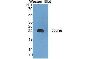 Western blot analysis of the recombinant protein. (UMPS antibody  (AA 311-481))