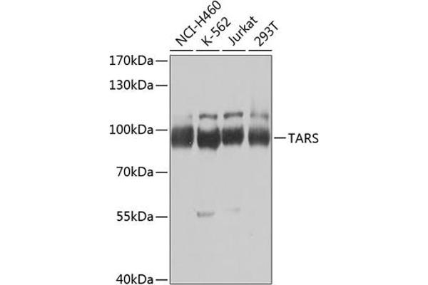 TARS antibody  (AA 1-230)
