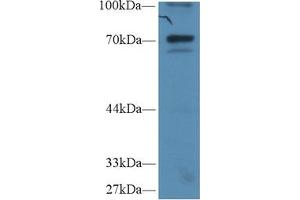 Western Blot; Sample: Human Hela cell lysate; Primary Ab: 1µg/ml Rabbit Anti-Human IkBz Antibody Second Ab: 0. (Inhibitory Subunit of NF-KappaB zeta (AA 422-651) antibody)