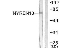 Western blot analysis of extracts from COS7 cells, using NYREN18 antibody.
