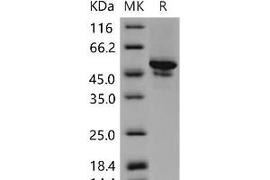 Western Blotting (WB) image for Carbonic Anhydrase IX (CA9) (Active) protein (His tag) (ABIN7194573) (CA9 Protein (His tag))