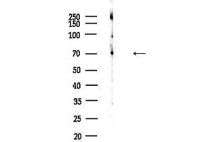 Western blot analysis of lysates from 3-L1 P6(heat-shock,45 min treatment), using CA Antibody at 1/1000 dilution.