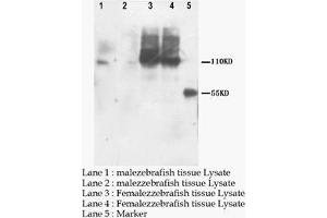 Western blot: PNPLA6 Polyclonal Antibody (PNPLA6 antibody  (C-Term))