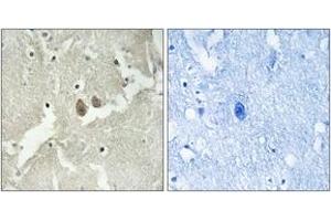 Immunohistochemistry analysis of paraffin-embedded human brain tissue, using NSG2 Antibody.