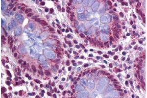 Human Colon: Formalin-Fixed, Paraffin-Embedded (FFPE) (KPNA4 antibody  (N-Term))