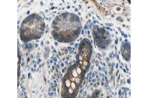 ABIN6266773 at 1/100 staining human colon tissue sections by IHC-P. (TNFSF13 antibody  (Internal Region))
