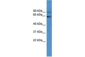 Image no. 1 for anti-Fragile X Mental Retardation 1 (FMR1) (AA 421-470) antibody (ABIN6746187) (FMR1 antibody  (AA 421-470))