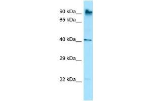Western Blotting (WB) image for anti-Membrane-Associated Ring Finger (C3HC4) 10, E3 Ubiquitin Protein Ligase (MARCH10) (C-Term) antibody (ABIN2781263)