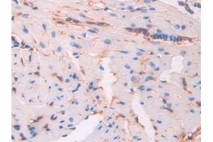 Detection of CD34 in Mouse Heart Tissue using Polyclonal Antibody to Cluster Of Differentiation 34 (CD34) (CD34 antibody  (AA 36-287))