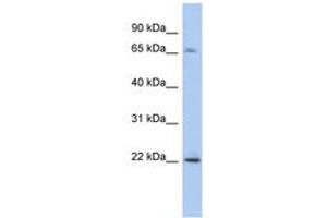 Image no. 1 for anti-PDGFA Associated Protein 1 (PDAP1) (N-Term) antibody (ABIN6743284) (PDAP1 antibody  (N-Term))