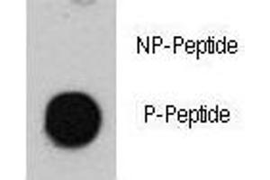 Dot blot analysis of phospho-ATM antibody. (ATM antibody  (pSer1981))