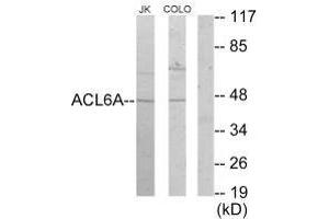 Western blot analysis of extracts from Jurkat cells and COLO205 cells, using ACL6A antibody. (BAF53A antibody)