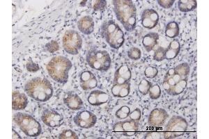 Immunoperoxidase of purified MaxPab antibody to IL17F on formalin-fixed paraffin-embedded human small Intestine. (IL17F antibody  (AA 1-163))