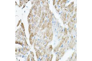 Immunohistochemistry of paraffin-embedded rat heart using VEGFB Rabbit pAb (ABIN7271298) at dilution of 1:150 (40x lens). (VEGFB antibody  (AA 25-207))