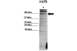 WB Suggested Anti-KAT5 Antibody  Positive Control: Lane 1: 50ug human RKO lysate  Primary Antibody Dilution :  1:500  Secondary Antibody : Goat anti-rabbit-Alexa Fluor 680  Secondry Antibody Dilution :  1:5000  Submitted by: Dr. (KAT5 antibody  (C-Term))