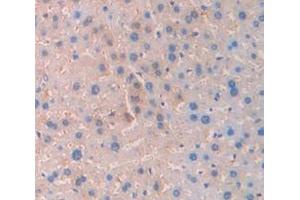 IHC-P analysis of Mouse Tissue, with DAB staining. (SERPINC1 antibody  (AA 33-465))