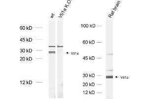dilution: 1 : 1000, sample: brain homogenate from wildtype and Vti1a K. (VTI1A antibody)
