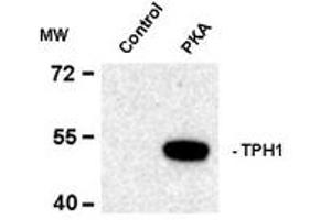 Image no. 2 for anti-Tryptophan Hydroxylase 1 (TPH1) (pSer58) antibody (ABIN227714) (Tryptophan Hydroxylase 1 antibody  (pSer58))