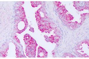 Image no. 1 for anti-Cysteine-Rich Secretory Protein 3 (CRISP3) (AA 69-118) antibody (ABIN6749801) (CRISP3 antibody  (AA 69-118))