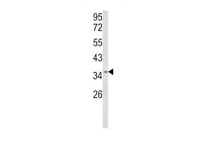 Western blot analysis of HSP Antibody (Center) (ABIN652514 and ABIN2842344) in MDA-M cell line lysates (35 μg/lane). (BRISC and BRCA1 A Complex Member 1 (BABAM1) (AA 116-143) antibody)