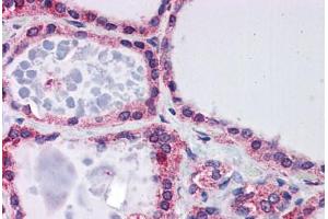 Human Thyroid: Formalin-Fixed, Paraffin-Embedded (FFPE) (Frataxin antibody  (AA 105-154))