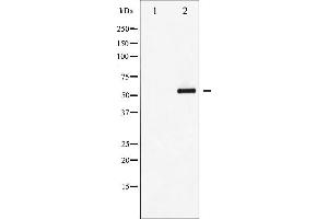 Western Blotting (WB) image for anti-Myocyte Enhancer Factor 2A (MEF2A) (pThr312) antibody (ABIN6256540)